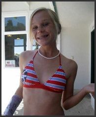 Teens with braces nude