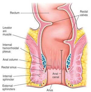 Sgt. C. reccomend Causes of sphincter swelling anal