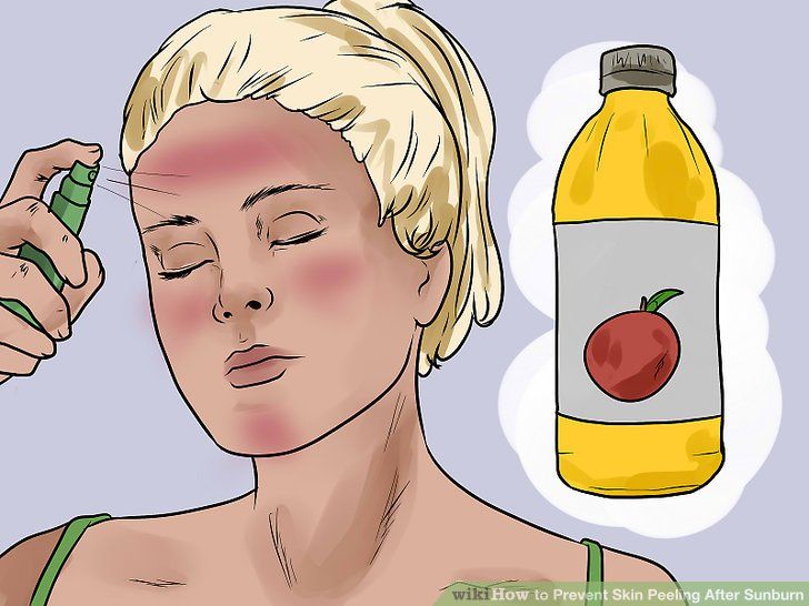 Home facial for peeling sunburns