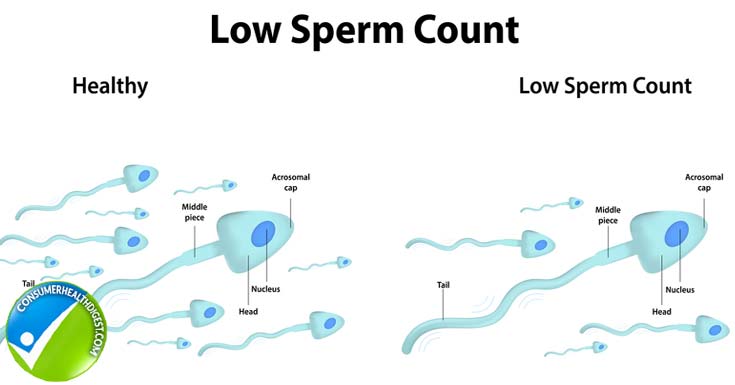 Twinkle T. reccomend Sperm count age