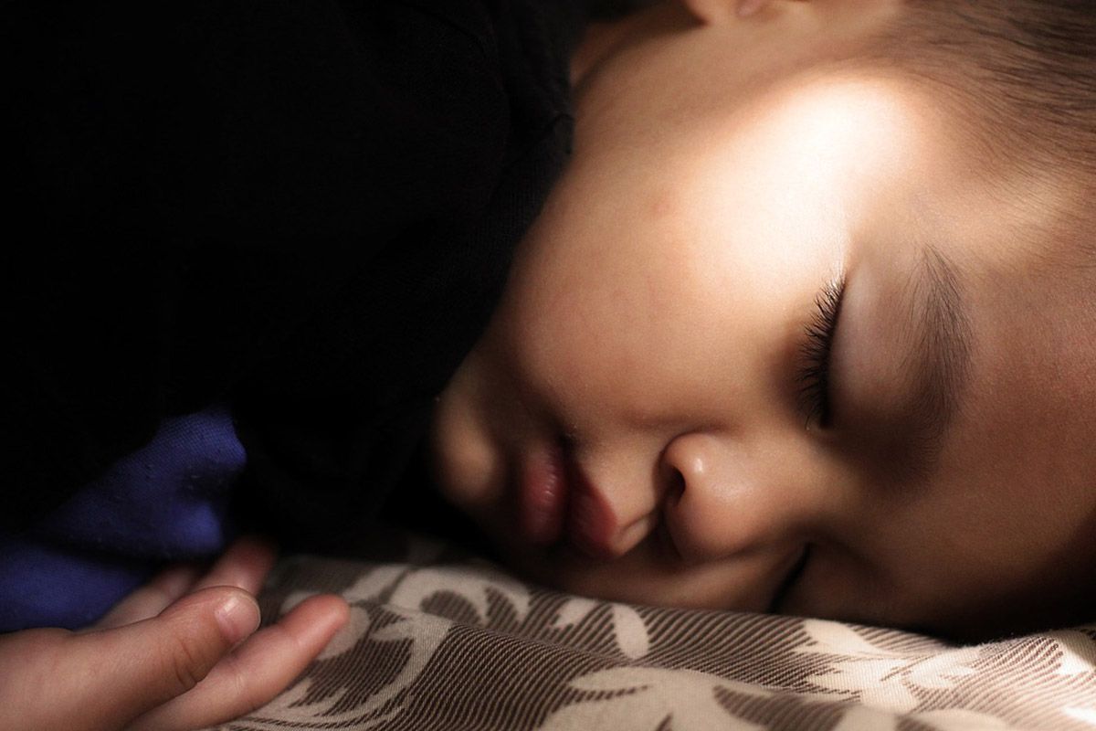 Herald reccomend Facial abnormalities sleep apnea