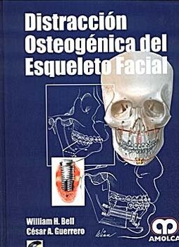 Distraction osteogenesis of the facial skeleton
