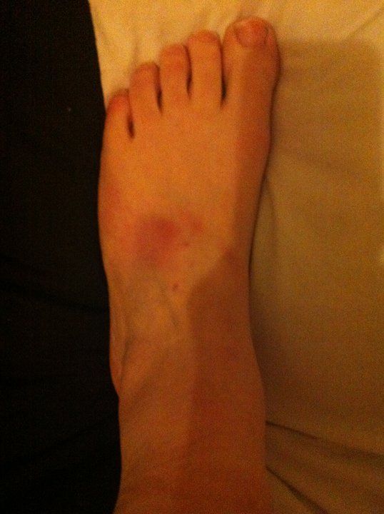 Air A. reccomend Amateur foot pic