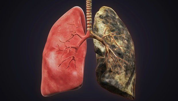 best of Smoking Lungs of