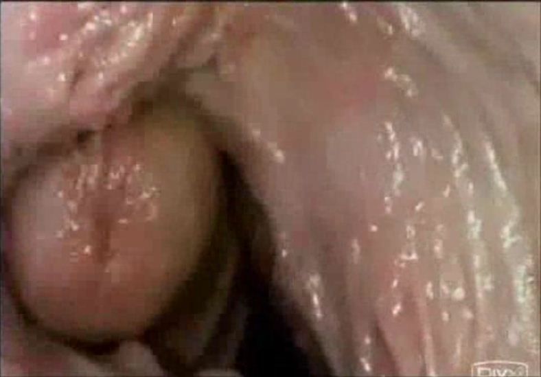 Internal Shots Of Pussy Cam - Cum inside vagina camera pictures . Porn Pics & Moveis.