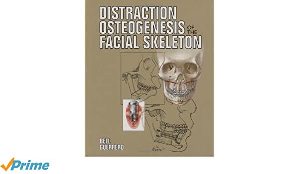 Hitch reccomend Distraction osteogenesis of the facial skeleton