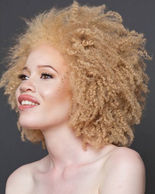 Albino black women in the nude