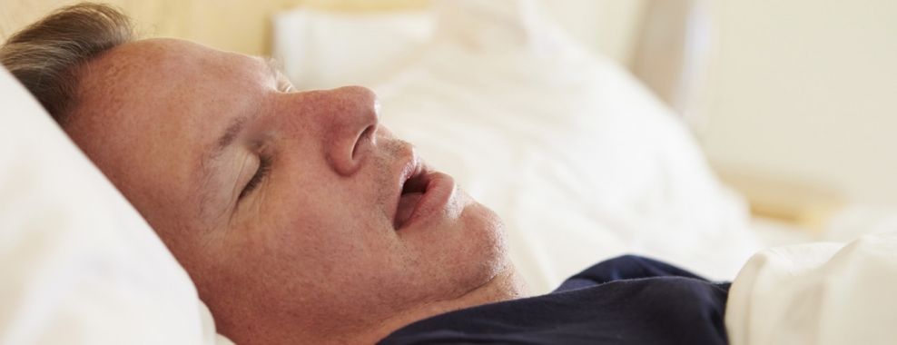Meatball reccomend Facial abnormalities sleep apnea
