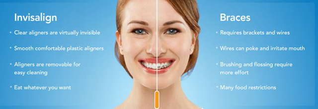 Tackle reccomend Alternatives to braces for adults