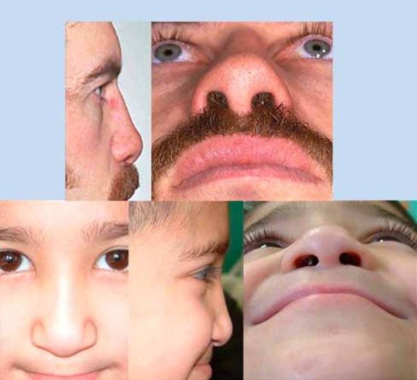 Flared nostrils facial meanings