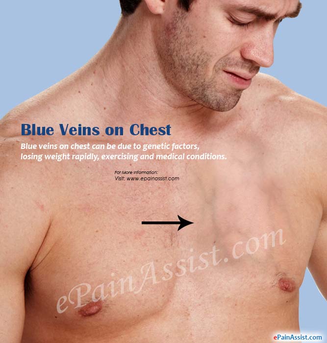 Kevlar reccomend Boob veins pictures