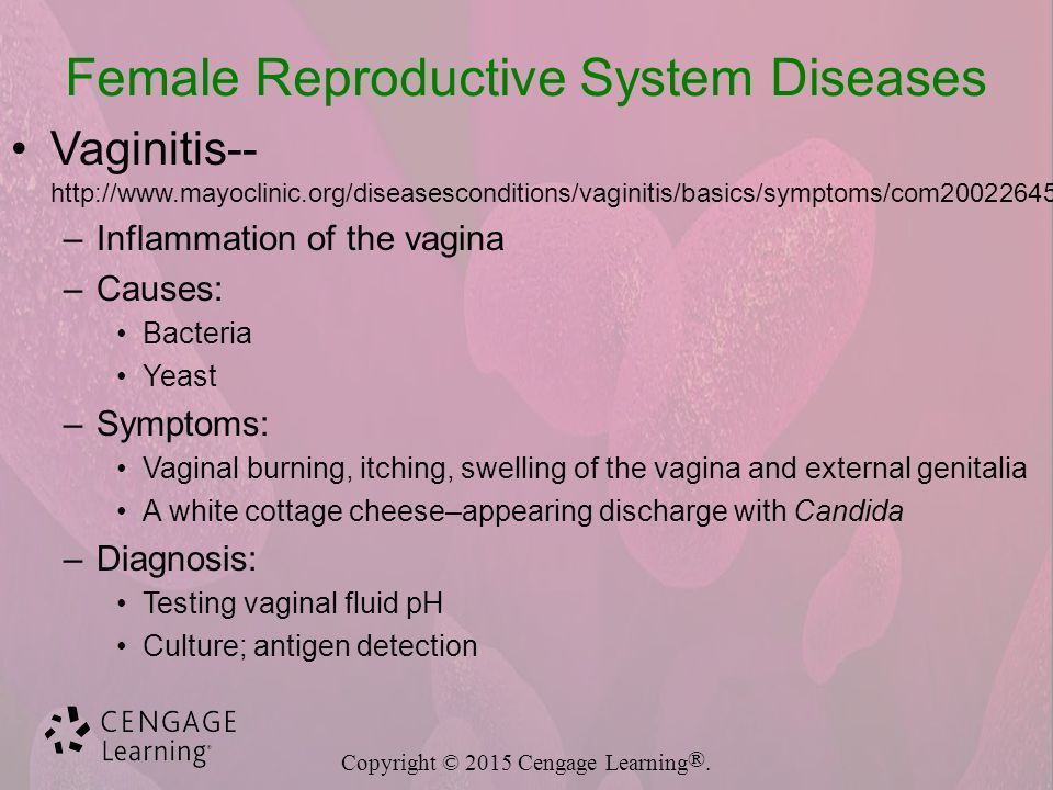 best of Vagina Burning irritation symtoms of