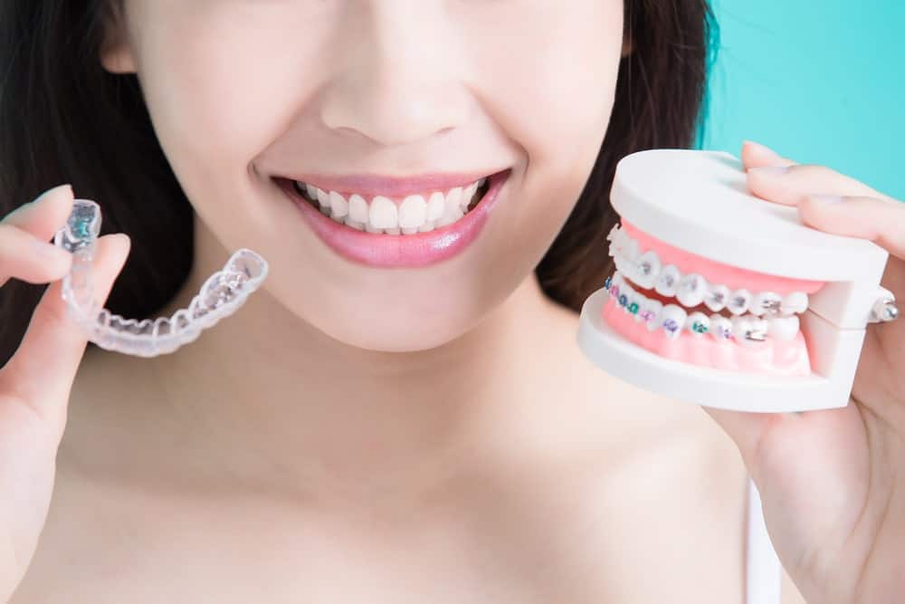 best of Braces Alternatives adults to for