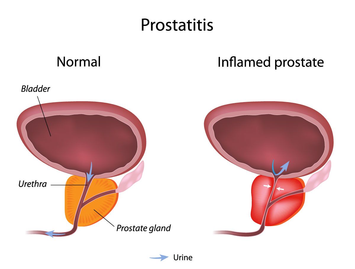 Dildo in your ass & masturbation - Anal training - Prostate stimulation.