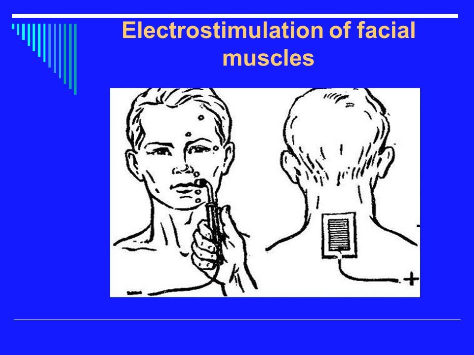 Stopper reccomend Estim for facial muscles
