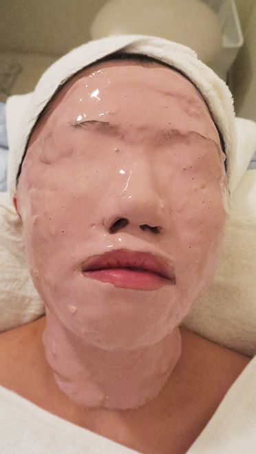 Twizzler reccomend Facial for acne
