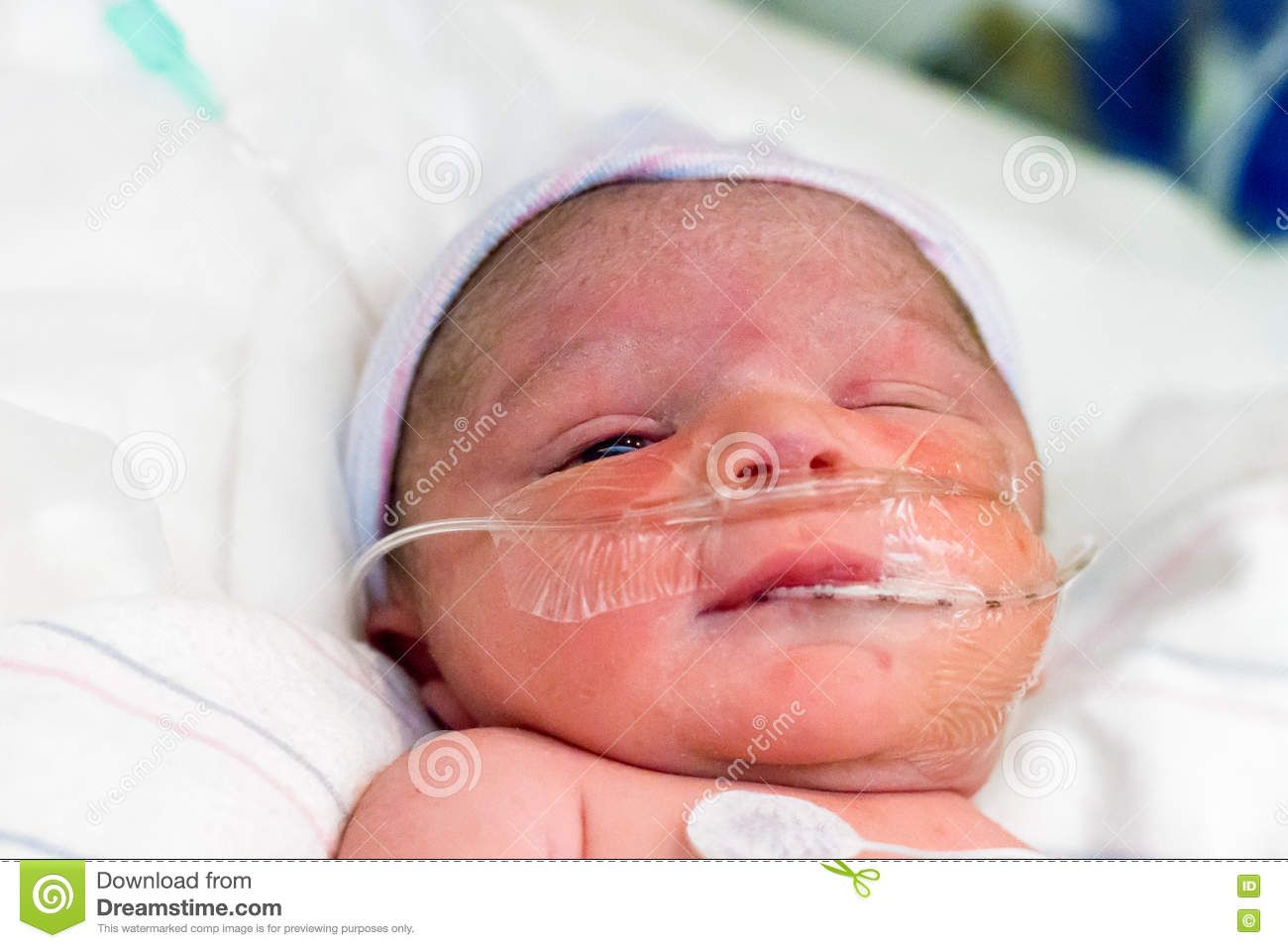 best of Oxygen and neonate Facial