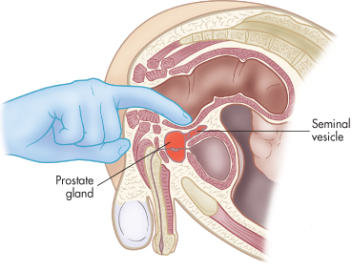 Anal itching and prostate