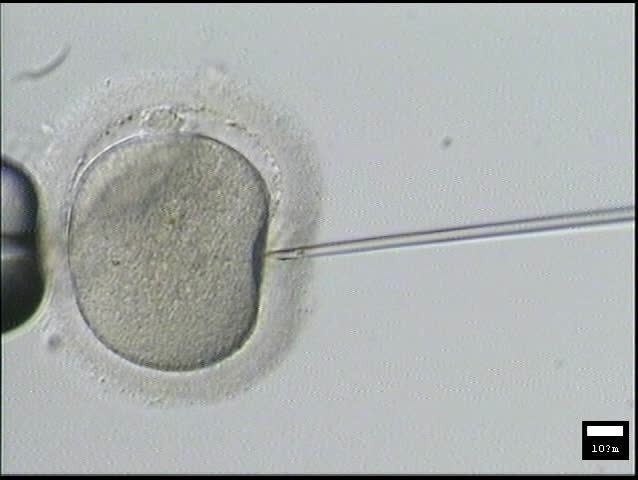 best of Egg sperm footage Free lab and