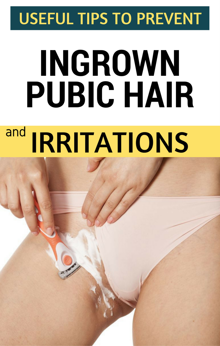 How to prevent ingrown hairs in bikini area