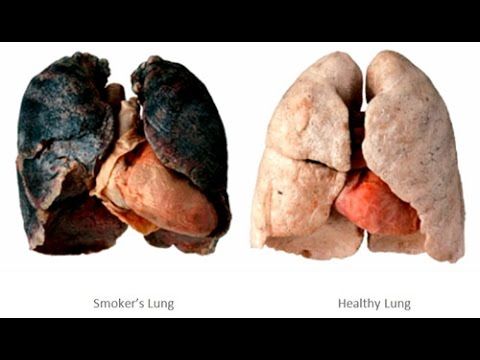best of Smoking Lungs of