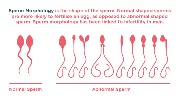 best of Sperm results Male count