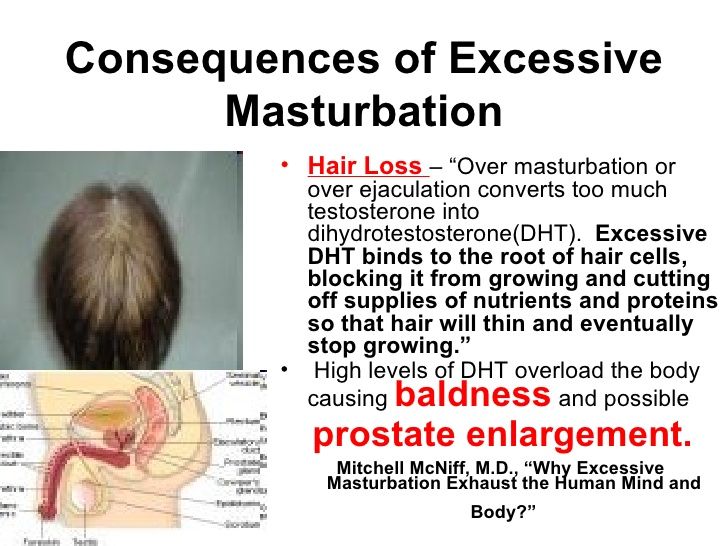 Count reccomend Prostatis from excessive masturbation