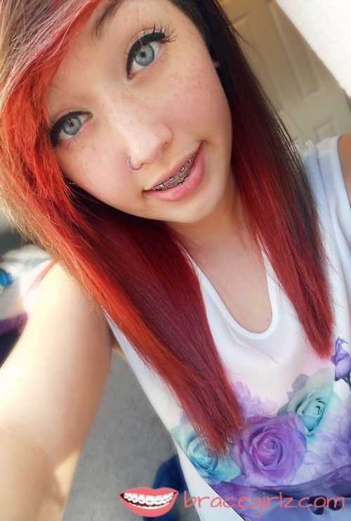 best of Braces with Redhead girls