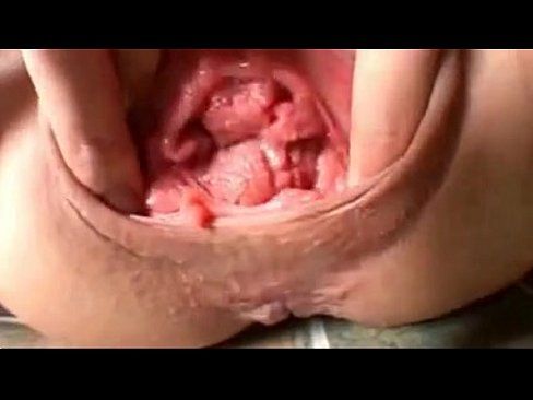 Halfback reccomend Ugly and weird looking pussy up close